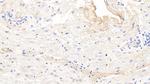 Fibrinogen Beta Chain Antibody in Immunohistochemistry (Paraffin) (IHC (P))