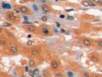 GLUT1 Antibody in Immunohistochemistry (Paraffin) (IHC (P))