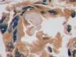 GLUT1 Antibody in Immunohistochemistry (Paraffin) (IHC (P))