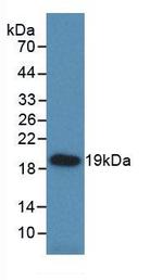 HSP20 Antibody in Western Blot (WB)