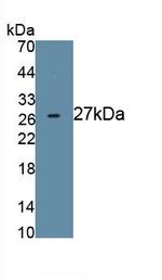 Nephrin Antibody in Western Blot (WB)