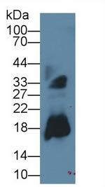 RNASE2 Antibody in Western Blot (WB)