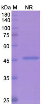 Ranibizumab Humanized Antibody in SDS-PAGE (SDS-PAGE)