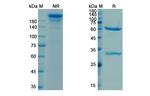 Cetuximab Chimeric Antibody in SDS-PAGE (SDS-PAGE)