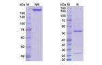 Volociximab Chimeric Antibody in SDS-PAGE (SDS-PAGE)