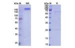 Ponezumab Humanized Antibody in SDS-PAGE (SDS-PAGE)