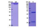 Quilizumab Humanized Antibody in SDS-PAGE (SDS-PAGE)