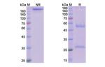 Nivolumab Antibody in SDS-PAGE (SDS-PAGE)