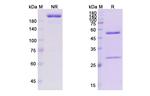 Obexelimab Chimeric Antibody in SDS-PAGE (SDS-PAGE)