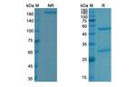 Evinacumab Antibody in SDS-PAGE (SDS-PAGE)