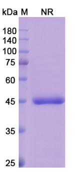 Abrezekimab Humanized Antibody in SDS-PAGE (SDS-PAGE)