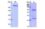 Zalifrelimab Antibody in SDS-PAGE (SDS-PAGE)