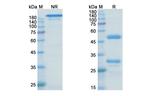 Zagotenemab Humanized Antibody in SDS-PAGE (SDS-PAGE)