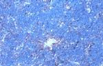 Phospho-GRK2 (Ser670) Antibody in Immunohistochemistry (Paraffin) (IHC (P))