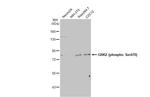 Phospho-GRK2 (Ser670) Antibody in Western Blot (WB)