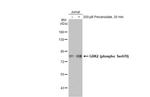 Phospho-GRK2 (Ser670) Antibody in Western Blot (WB)