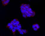 IFNAR1 Antibody in Immunocytochemistry (ICC/IF)