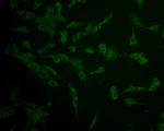 IFNAR1 Antibody in Immunocytochemistry (ICC/IF)