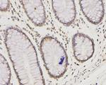 IFNAR1 Antibody in Immunohistochemistry (Paraffin) (IHC (P))