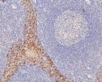 Cytokeratin 5/6 Antibody in Immunohistochemistry (Paraffin) (IHC (P))