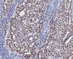 MSH6 Antibody in Immunohistochemistry (Paraffin) (IHC (P))