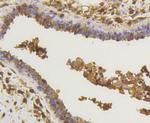 NFkB p65 Antibody in Immunohistochemistry (Paraffin) (IHC (P))