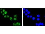 FOXO3A Antibody in Immunocytochemistry (ICC/IF)