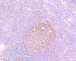 Survivin Antibody in Immunohistochemistry (Paraffin) (IHC (P))