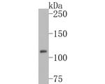 Phospho-JAK2 (Tyr1007, Tyr1008) Antibody in Western Blot (WB)