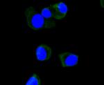 ApoA1 Antibody in Immunocytochemistry (ICC/IF)