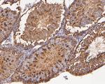 PGD Antibody in Immunohistochemistry (Paraffin) (IHC (P))