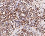 HLA-DRB4 Antibody in Immunohistochemistry (Paraffin) (IHC (P))