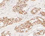 HDGF Antibody in Immunohistochemistry (Paraffin) (IHC (P))