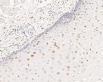 HDGF Antibody in Immunohistochemistry (Paraffin) (IHC (P))