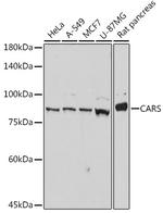 CARS Antibody in Western Blot (WB)