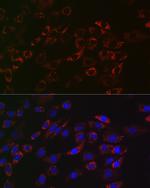 ACAA2 Antibody in Immunocytochemistry (ICC/IF)