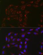 ACAA2 Antibody in Immunocytochemistry (ICC/IF)