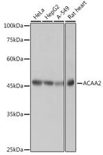 ACAA2 Antibody in Western Blot (WB)