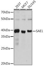 SAE1 Antibody in Western Blot (WB)