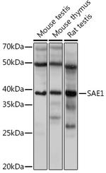 SAE1 Antibody in Western Blot (WB)