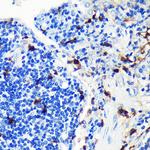 S100A8 Antibody in Immunohistochemistry (Paraffin) (IHC (P))