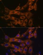 FASN Antibody in Immunocytochemistry (ICC/IF)