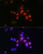 FOXA2 Antibody in Immunocytochemistry (ICC/IF)