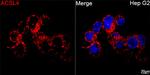 ACSL4 Antibody in Immunocytochemistry (ICC/IF)