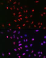 H3K18me1 Antibody in Immunocytochemistry (ICC/IF)