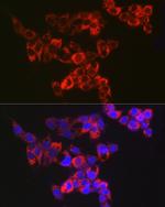 Adenylate Kinase 4 Antibody in Immunocytochemistry (ICC/IF)