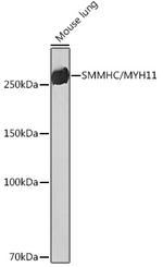 MYH11 Antibody in Western Blot (WB)