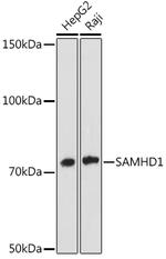 SAMHD1 Antibody in Western Blot (WB)