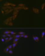 Cytochrome P450 Reductase Antibody in Immunocytochemistry (ICC/IF)