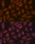 CAD Antibody in Immunocytochemistry (ICC/IF)